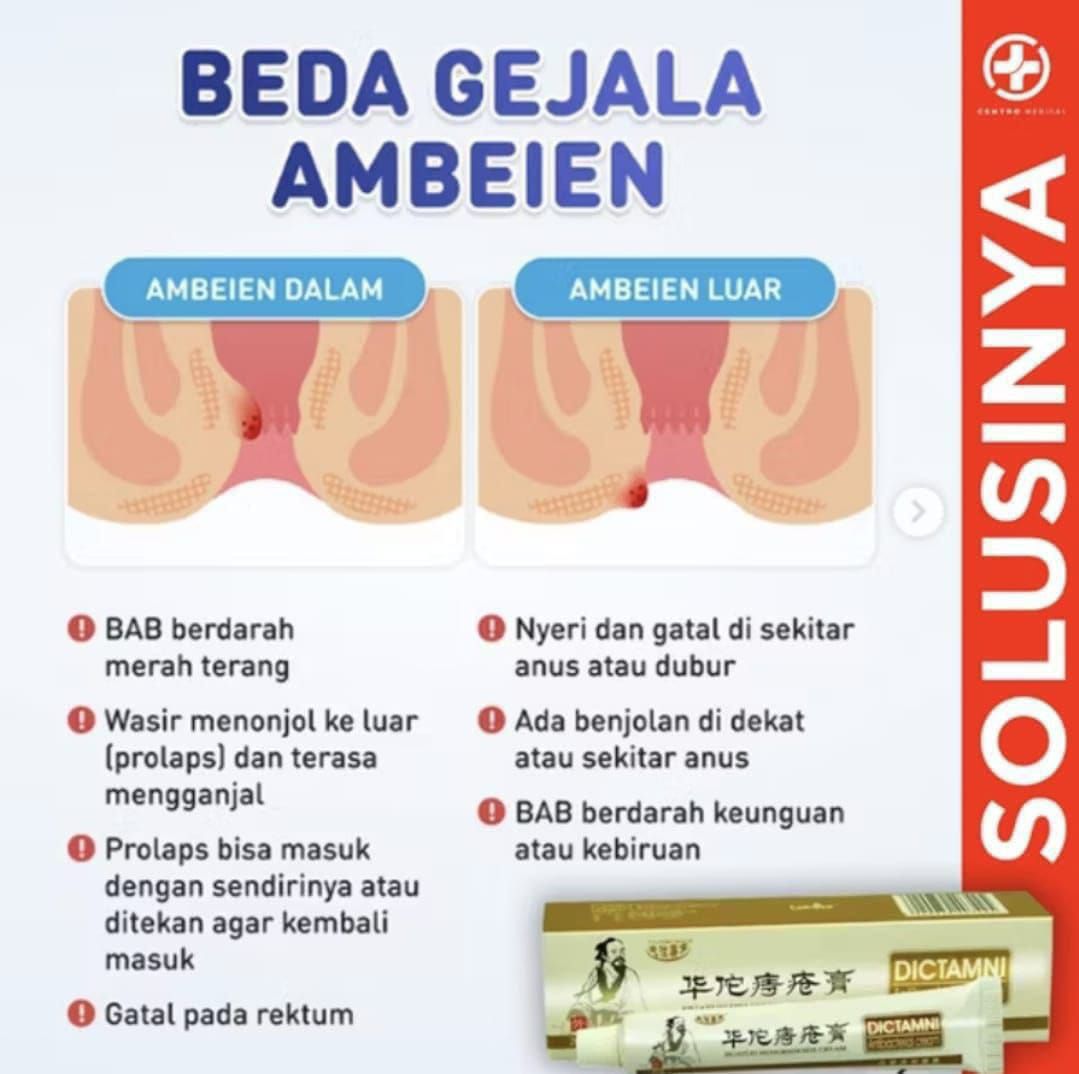 Salep wasir